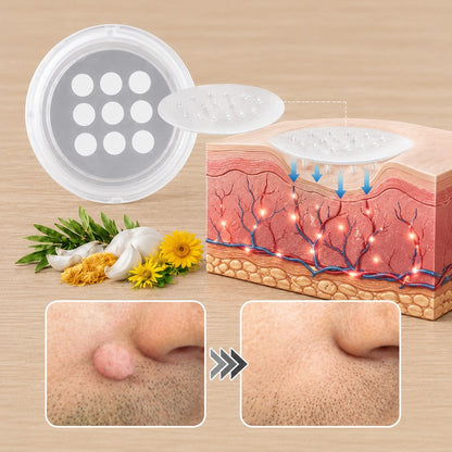 💖💖💖PuraCure® 2 v 1 mikroihličková a hydrokoloidná náplasť 🍀 | Na starostlivosť o vystúpené znamienka, akné, ploché bradavice a kožné výrastky | Pomáha redukovať vzhľad vrások, jaziev a nedokonalostí pokožky | Neviditeľná náplasť na tvár a telo