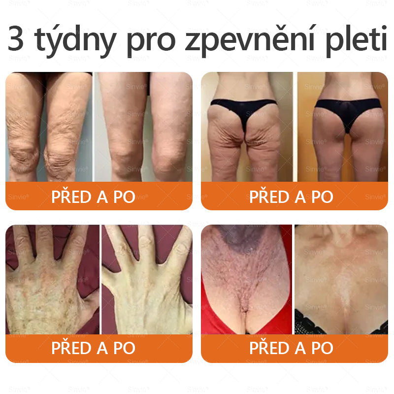 🧡PuraCure® Krém na obnovu pleti s včelím jedem 🔥 Český vývoj, výroba a dodávka v České republice