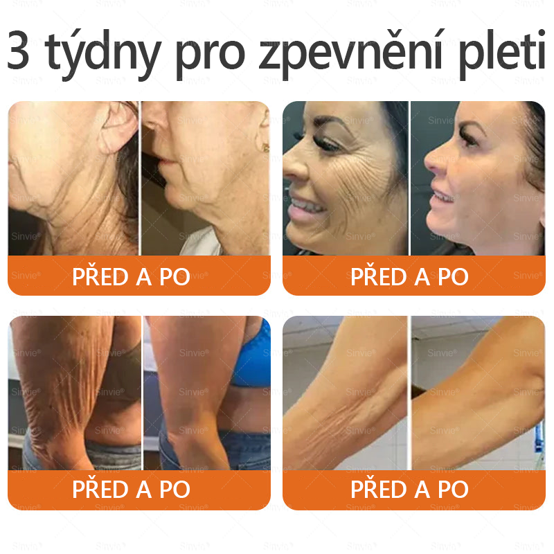 🧡PuraCure® Krém na obnovu pleti s včelím jedem 🔥 Český vývoj, výroba a dodávka v České republice
