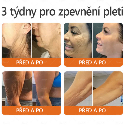 🧡PuraCure® Krém na obnovu pleti s včelím jedem 🔥 Český vývoj, výroba a dodávka v České republice