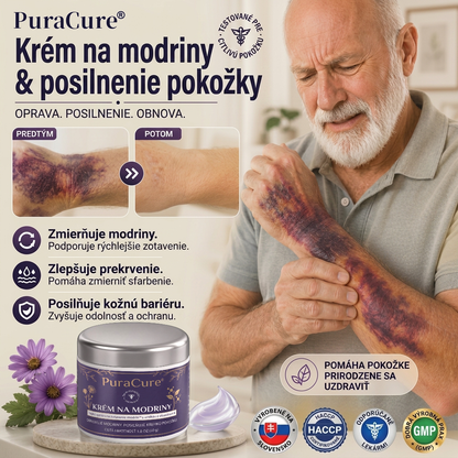 ⭐️ 100 000+ predaných kusov 💁‍♀️ – PuraCure® Regeneračný krém na modriny a spevnenie pokožky
