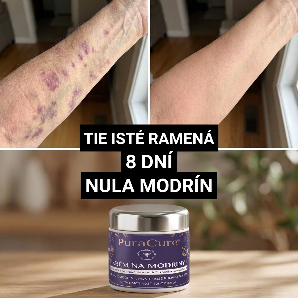 ⭐️ 100 000+ predaných kusov 💁‍♀️ – PuraCure® Regeneračný krém na modriny a spevnenie pokožky