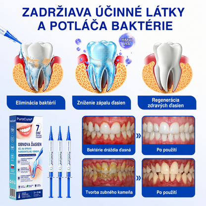 🌈🌈🌈𝑷𝒖𝒓𝒂𝑪𝒖𝒓𝒆® 👨‍⚕️🦷𝑶𝑩𝑵𝑶𝑽𝑨 Ď𝑨𝑺𝑰𝑬𝑵 𝑷𝒂𝒓𝒐𝒅𝒐𝒏𝒕á𝒍𝒏𝒚 𝒐𝒑𝒓𝒂𝒗𝒏ý 𝒈é𝒍🥬