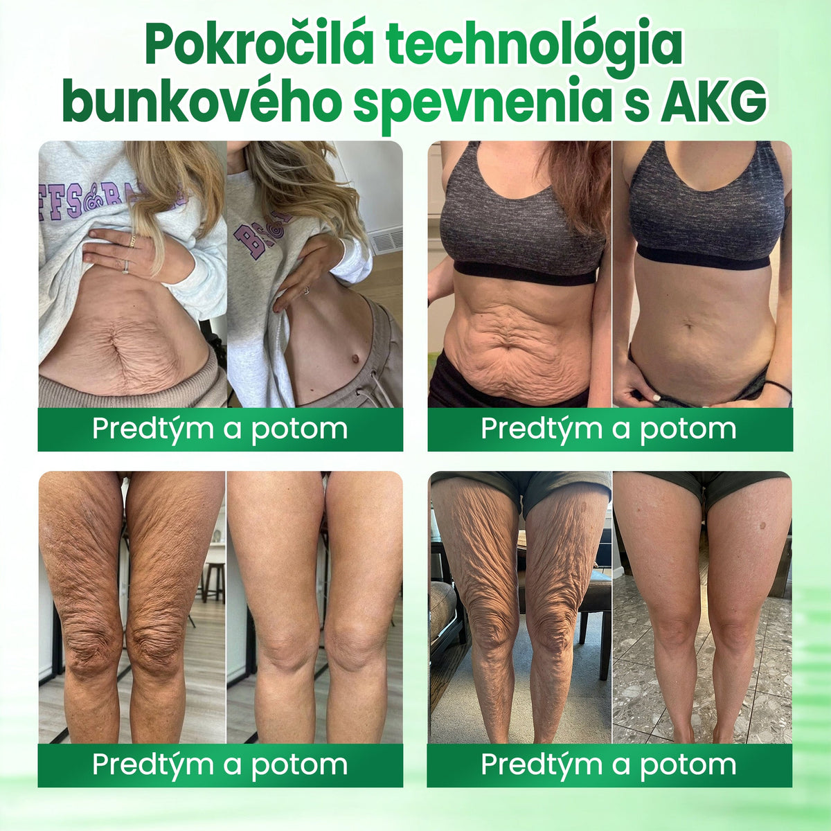 🌼Medistart® SPEVŇUJÚCA & PROTI STARNUTIU PLEŤOVÁ STAROSTLIVOSŤ