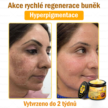 🧡PuraCure® Krém na obnovu pleti s včelím jedem 🔥 Český vývoj, výroba a dodávka v České republice