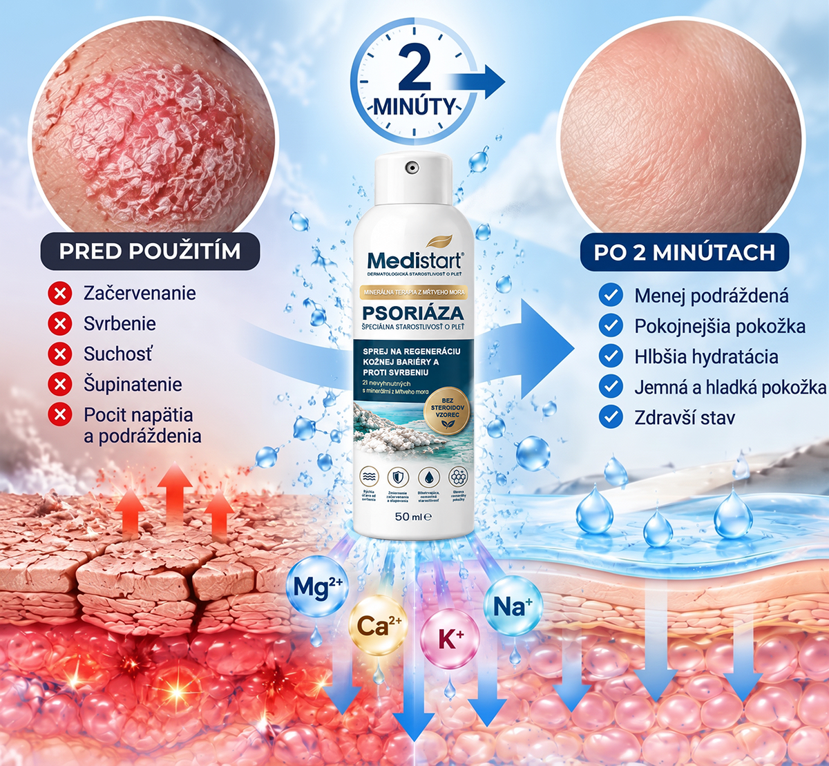 ✨✨✨Medistart® ŠPECIÁLNA STAROSTLIVOSŤ O POKOŽKU PRI PSORIÁZE