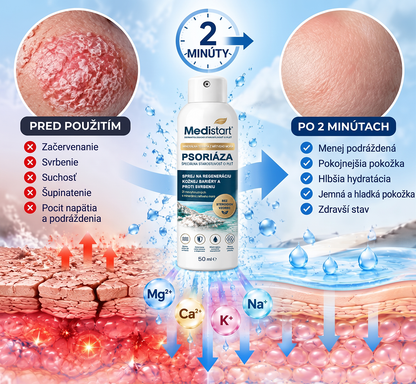 ✨✨✨Medistart® ŠPECIÁLNA STAROSTLIVOSŤ O POKOŽKU PRI PSORIÁZE