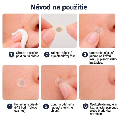 💖💖💖PuraCure® 2 v 1 mikroihličková a hydrokoloidná náplasť 🍀 | Na starostlivosť o vystúpené znamienka, akné, ploché bradavice a kožné výrastky | Pomáha redukovať vzhľad vrások, jaziev a nedokonalostí pokožky | Neviditeľná náplasť na tvár a telo