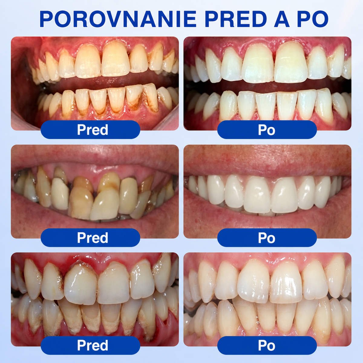 🌈🌈🌈𝑷𝒖𝒓𝒂𝑪𝒖𝒓𝒆® 👨‍⚕️🦷𝑶𝑩𝑵𝑶𝑽𝑨 Ď𝑨𝑺𝑰𝑬𝑵 𝑷𝒂𝒓𝒐𝒅𝒐𝒏𝒕á𝒍𝒏𝒚 𝒐𝒑𝒓𝒂𝒗𝒏ý 𝒈é𝒍🥬