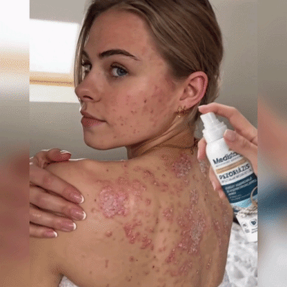 ✨✨✨Medistart® ŠPECIÁLNA STAROSTLIVOSŤ O POKOŽKU PRI PSORIÁZE